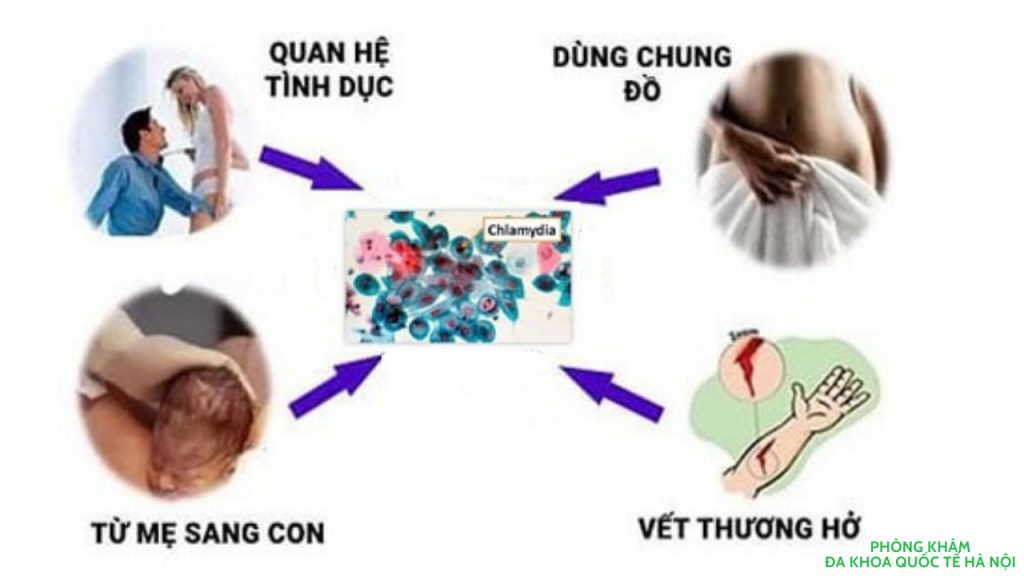bệnh chlamydia lây nhiễm như thế nào