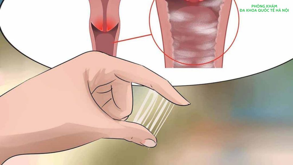 khí hư có màu bất thường