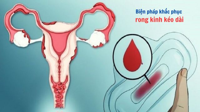 biên pháp khắc phục rong kinh