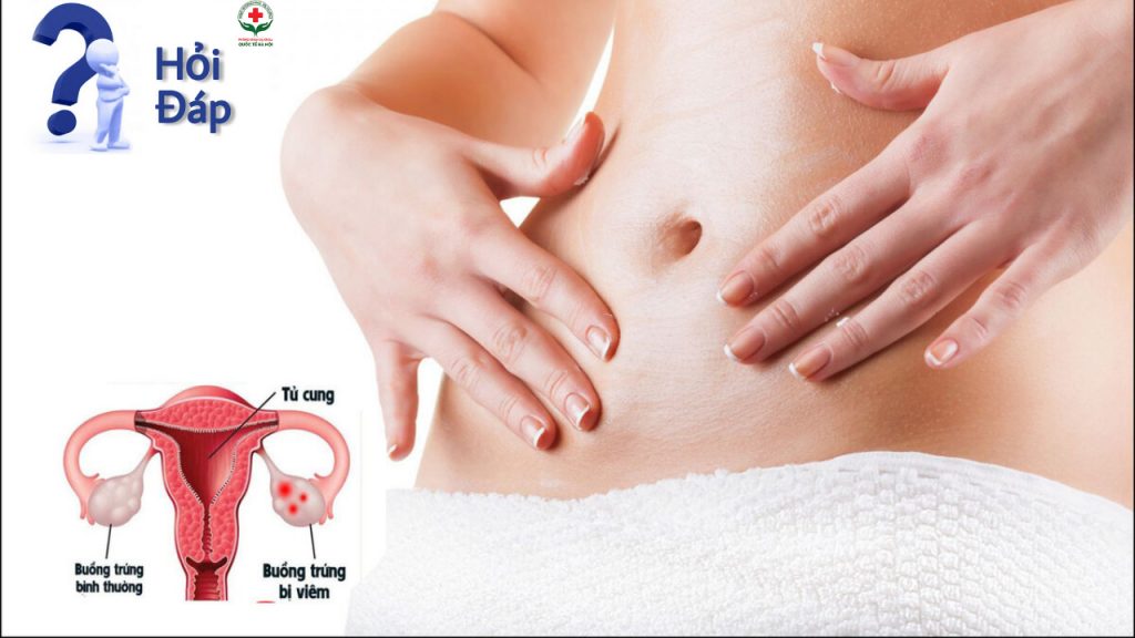Các biểu hiện của bệnh viêm ống dẫn trứng
