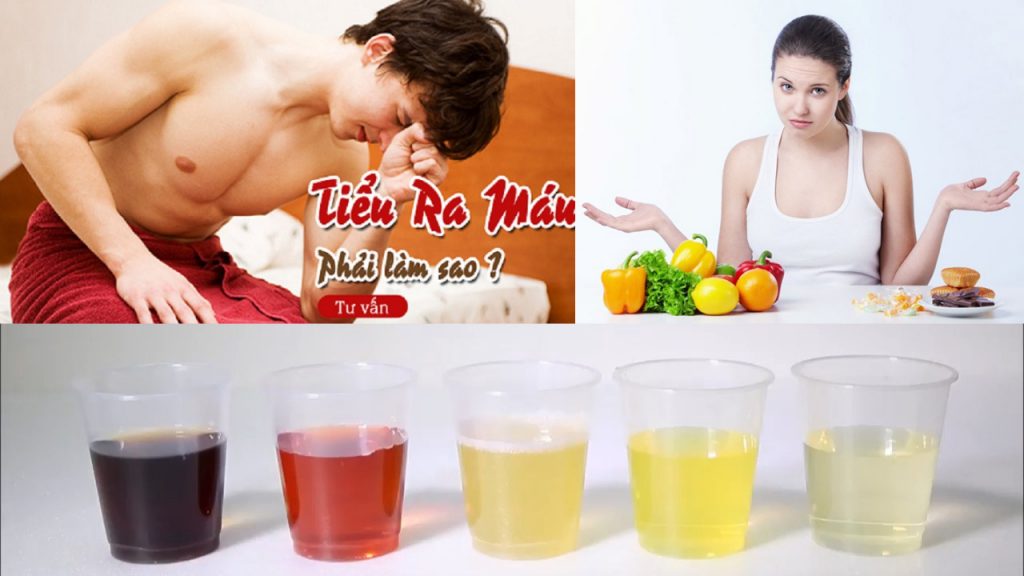 cách chữa đi tiểu ra máu