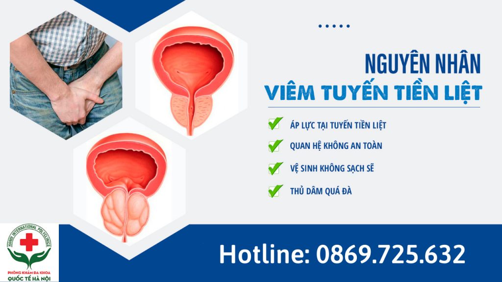 Nguyên nhân bệnh viêm tiền liệt tuyến