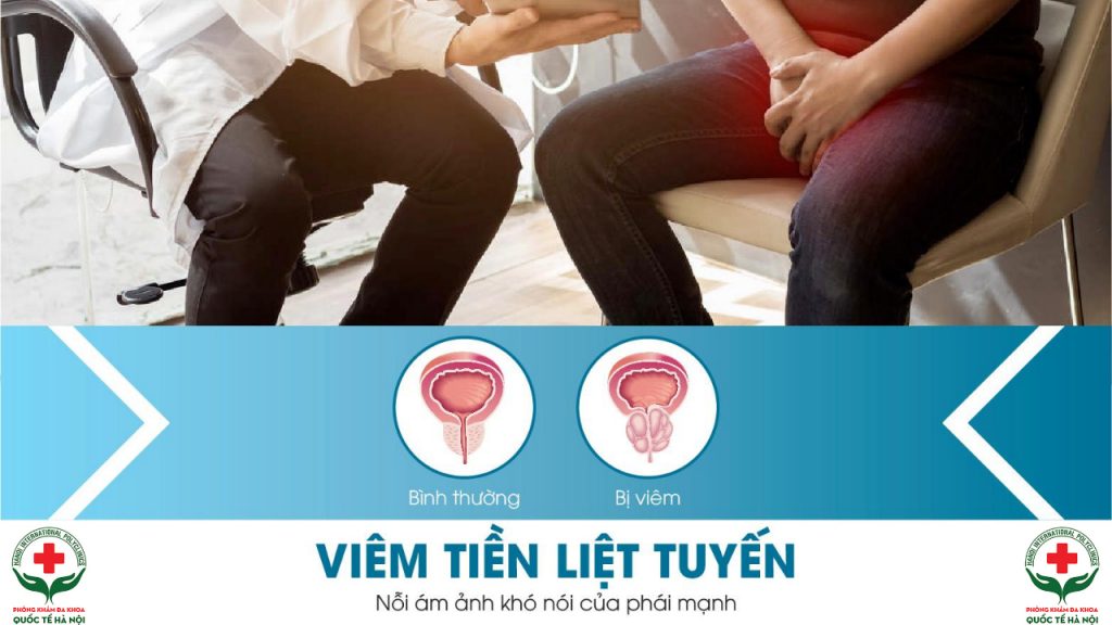 viêm tiền liệt tuyến