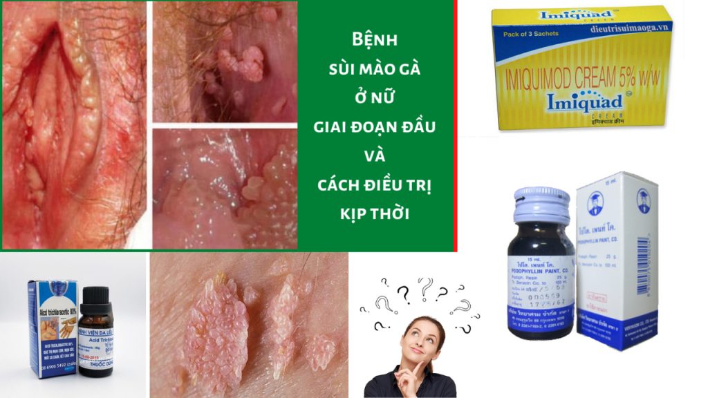 Thuốc trị sùi mào gà ở nữ