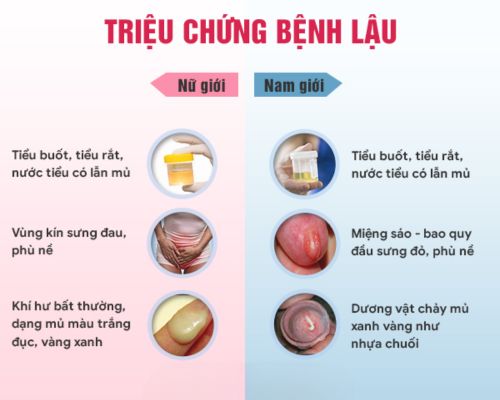 triệu chứng nhận biết bệnh lậu